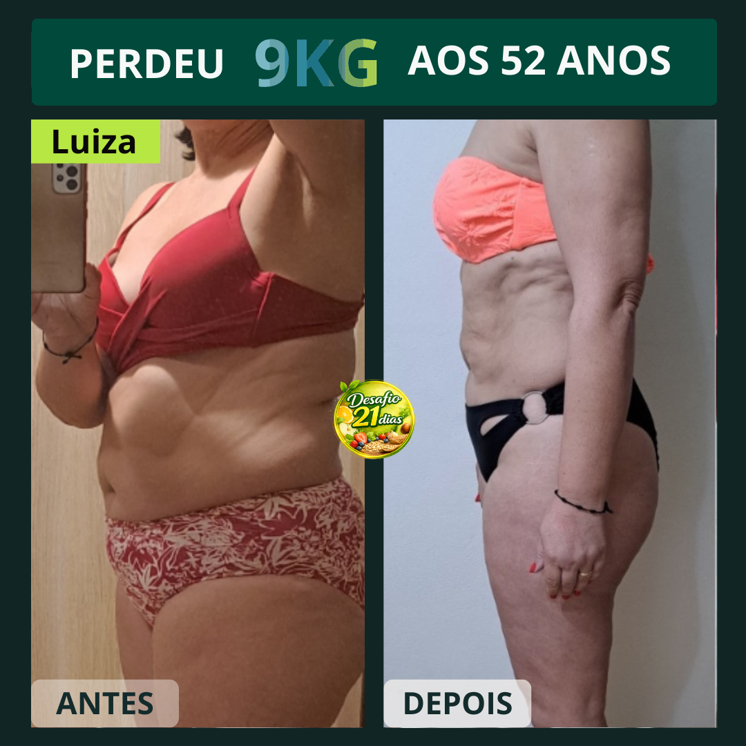 Antes e Depois 4